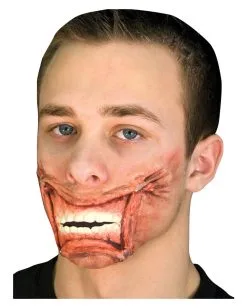 Mund Wunde Getackert